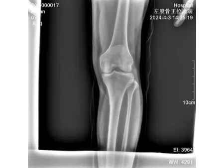 Caméra à rayons X numérique portable SMART/Radiographie portable ou mobile SMART