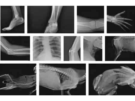 Caméra à rayons X numérique portable SMART/Radiographie portable ou mobile SMART