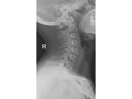 Mobile de radiographie numérique/Radio mobile numérique
