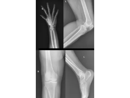 Mobile de radiographie numérique/Radio mobile numérique