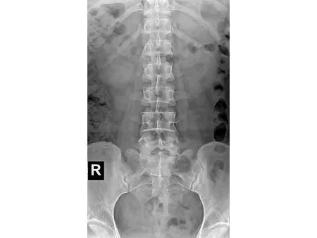 Mobile de radiographie numérique/Radio mobile numérique