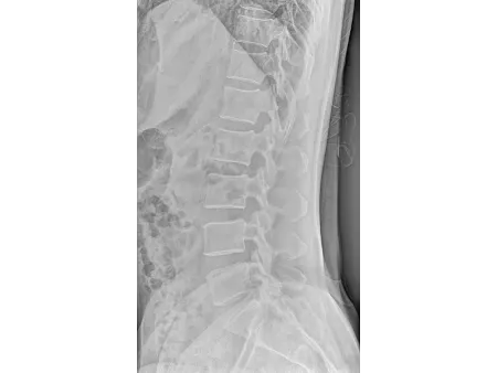 Mobile de radiographie numérique/Radio mobile numérique
