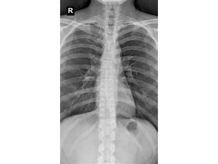 Mobile de radiographie numérique/Radio mobile numérique