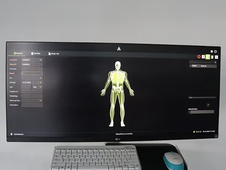 Arceau chirurgical mobile à capteur plan