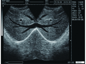 Système de diagnostic à ultrasons numérique  WED-9618CII