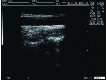 Système de diagnostic à ultrasons numérique  WED-9618CII