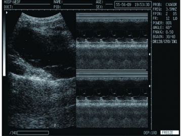 Système de diagnostic à ultrasons numérique  WED-9618CII