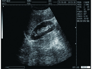 Système de diagnostic à ultrasons numérique  WED-9618CII