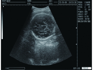 Système de diagnostic à ultrasons numérique  WED-9618CII