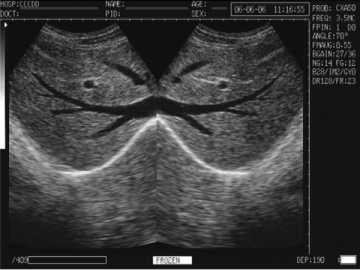 Système de diagnostic à ultrasons numérique WED-3000