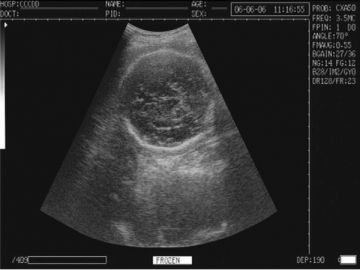 Système de diagnostic à ultrasons numérique WED-3000