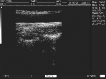 Système de diagnostic à ultrasons numérique WED-3000