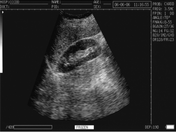 Système de diagnostic à ultrasons numérique WED-3000