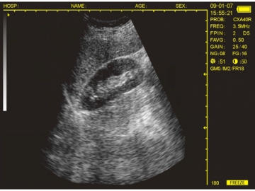 Système de diagnostic à ultrasons numérique WED-3100