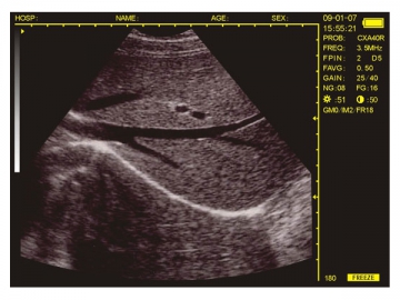 Système de diagnostic à ultrasons numérique WED-3100