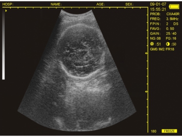 Système de diagnostic à ultrasons numérique WED-3100