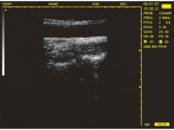 Système de diagnostic à ultrasons numérique WED-3100