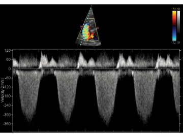 Echographe numérique Doppler couleur FDC8000