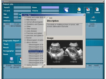 Echographe numérique WED-160